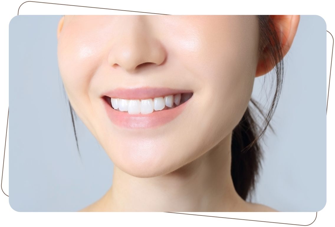 大人の矯正治療